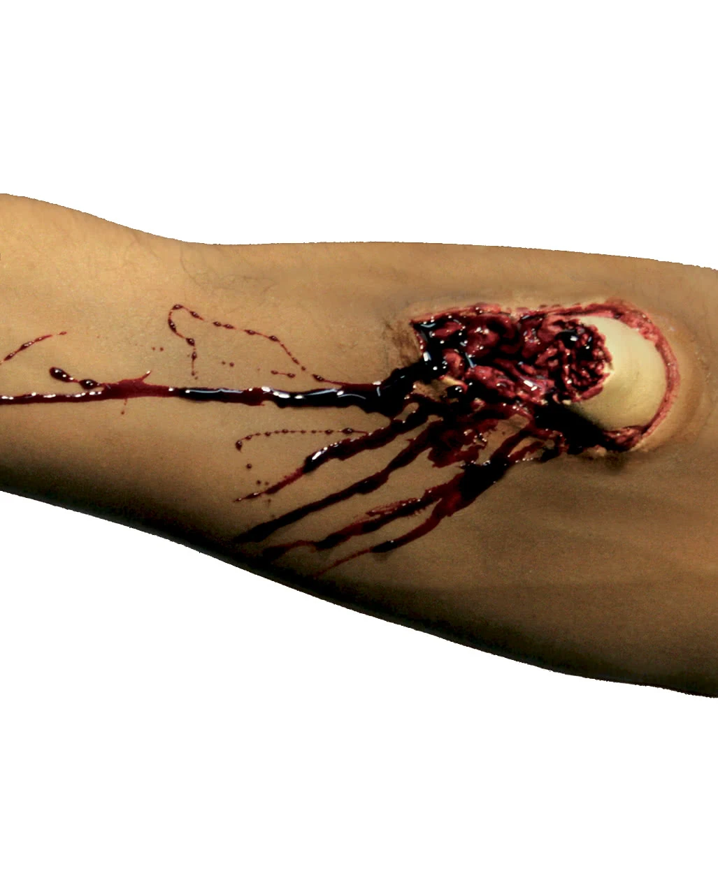 Blutige Knochenbruch Wunde 3 Blutige Knochenbruch Wunde