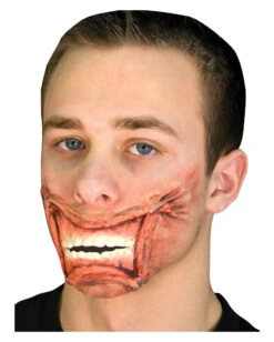 Mund Wunde Getackert